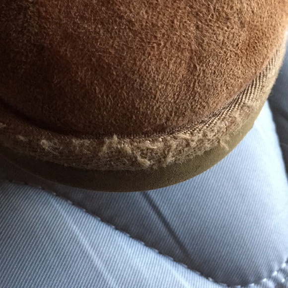 UGG Bailey Button Short - Picture 5 of 5